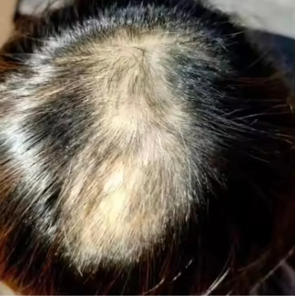 HairsKing™ – Κρέμα Μαλλιών για Άμεση Πυκνότητα