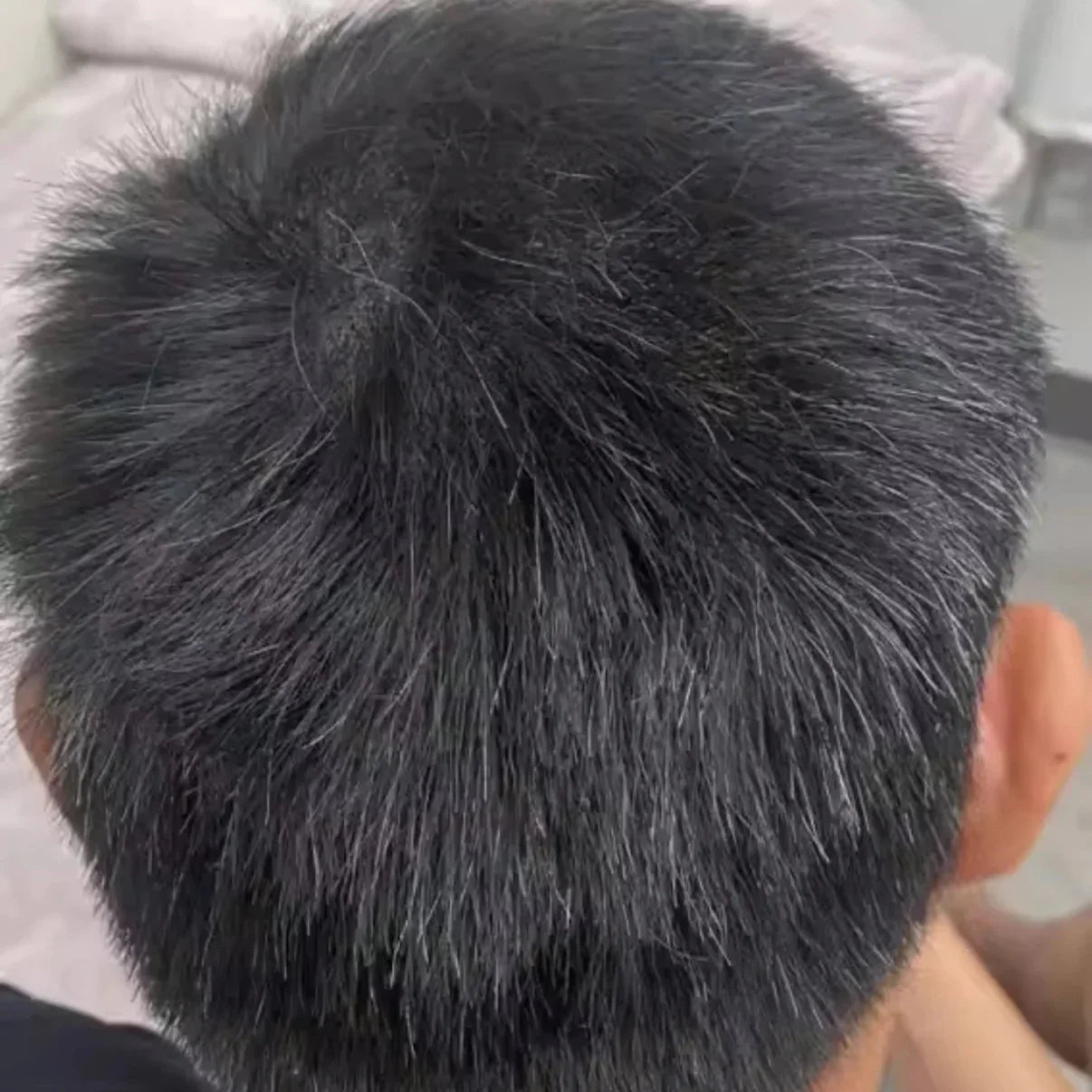 HairsKing™ – Κρέμα Μαλλιών για Άμεση Πυκνότητα